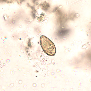 Egg of O. viverrini in an unstained wet mount of concentrated stool. Image taken at 400x magnification. Adapted from CDC