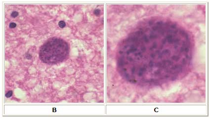 Toxoplasma gondii cyst, hematoxylin and eosin stain