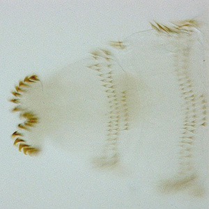 Close-up of the posterior end of the larva in Figure 1. Adapted from CDC