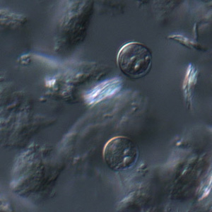 A pair of oocysts of C. cayetanensis viewed under DIC microscopy. Adapted from CDC