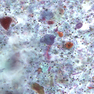 Trophozoite of R. intestinalis in a stool specimen, stained with trichrome. Adapted from CDC