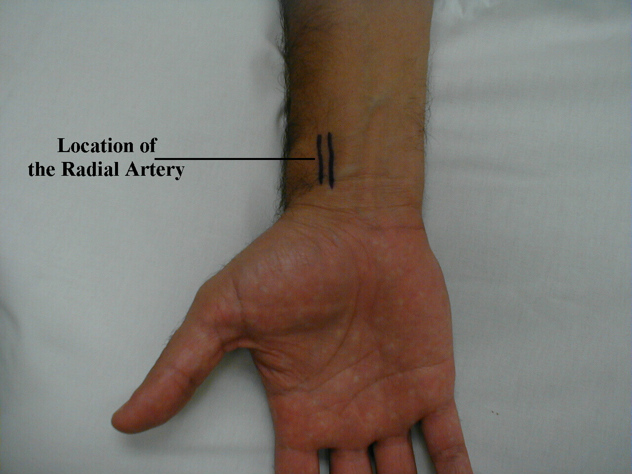 Location of the radial artery: Surface anatomy