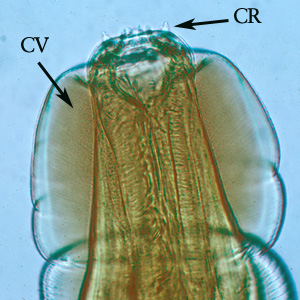 Higher magnification of the anterior end of the specimen in Figures 1 and 2. Note the presence of the cephalic vesicle (CV) and corona radiata (CR). Adapted from CDC