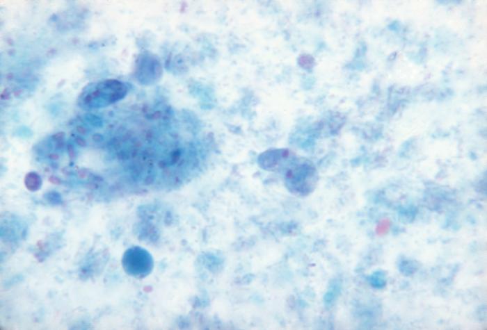Photomicrograph reveals the presence of a trichrome-stained, Dientamoeba fragilis parasitic trophozoites in this specimen. From Public Health Image Library (PHIL). [1]