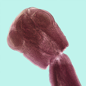 Scolex of Mesocestoides sp. stained with carmine. In this field, two of the suckers are clearly visible. Note that lack of rostellar hooklets. Adapted from CDC
