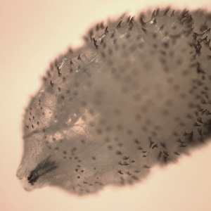 Anterior end of a larva of D. hominis. Image from a specimen courtesy of the Idaho State Health Department. Adapted from CDC