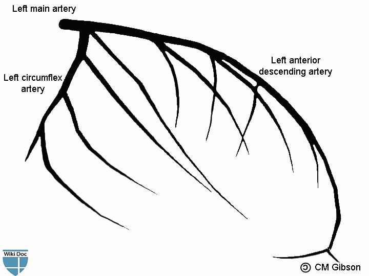 Left main artery bifurcates into left anterior descending artery and left circumflex artery