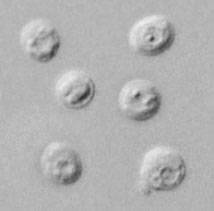 Cryptosporidium parvumoocysts in wet mount, under differential interference contrast (DIC) microscopy. The oocysts are rounded and measure 4.2 µm - 5.4 µm in diameter. Sporozoites are visible inside the oocysts, indicating that sporulation has occurred. Adapted from CDC