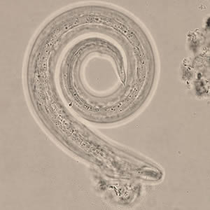 A. cantonensis L3, infective larvae, in wet mounts, recovered from slugs. Adapted from CDC