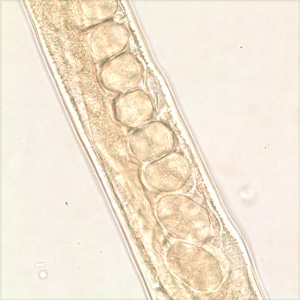 Midsection of the same specimen from Figures 1 and 2. Note a row of eggs in the uterus. Adapted from CDC