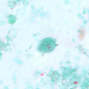 Cyst of C. mesnili in a stool specimen, stained with trichrome. Image taken at 1000x magnification. Adapted from CDC