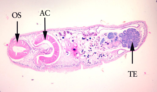 Adult Philophthalmus sp., removed from the conjunctiva of a patient, stained with hematoxylin and eosin (H&E). In this figure, the following structures are labeled: oral sucker (OS), acetabulum (AC), and of the large, paired testes (TE). The positioning of the specimen during preparation did not allow for demonstration of the large pharynx. Adapted from CDC