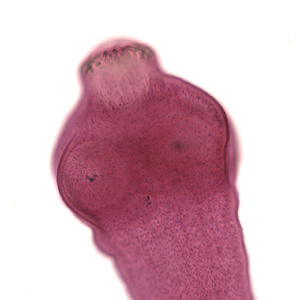 Close-up of the scolex of E. granulosus in Figure 1. In this focal plane, one of the suckers is clearly visible, as is the ring of rostellar hooks. Adapted from CDC