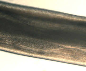 Close-up of the specimen in Figure 5 showing the cuticular ridging. A uterine tube can also be seen through the cuticle. Adapted from CDC