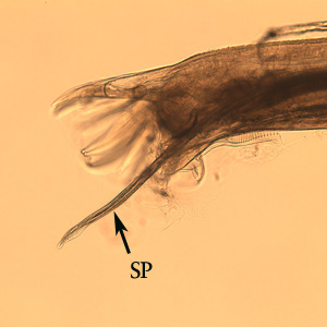 Posterior end of a male Oesophagostomum sp., Note the spicule (SP).