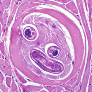 Encysted larvae of Trichinella sp. in muscle tissue, stained with hematoxylin and eosin (H&E). The image magnification is 400x. Adapted from CDC