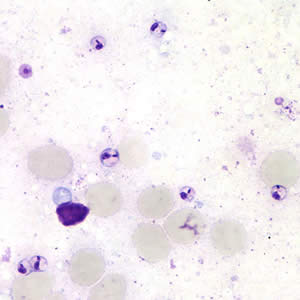 Leishmania sp. amastigotes; touch-prep stained with Giemsa. Adapted from CDC