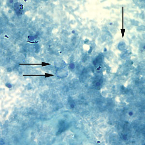 Unstained Cryptosporidium sp. oocysts (black arrows) on a slide stained with modified acid-fast. The slide was counterstained with malachite green. Adapted from CDC