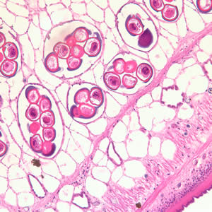 Cross-section of a D. caninum proglottid stained with H&E. Image taken at 200x magnfication. Adapted from CDC
