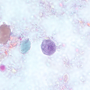 Trophozoite of E. hartmanni stained with trichrome. Adapted from CDC