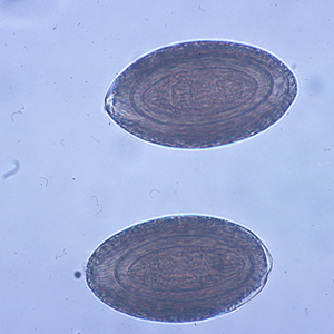 Eggs of M. hirudinaceous in an unstained wet mount of stool. Adapted from CDC
