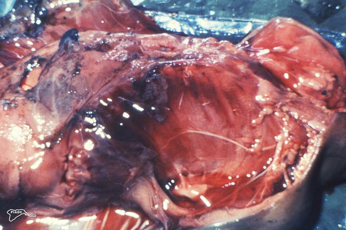Photograph depicts aborted fetal ruminant necropsy, revealing numerous hemorrhages, and a hemothorax (blood within the thoracic cavity). From Public Health Image Library (PHIL). [1]