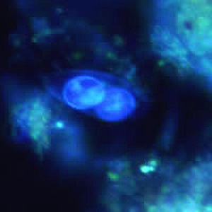 Oocyst of C. belli viewed under ultraviolet (UV) microscopy, showing two sporoblasts. Adapted from CDC