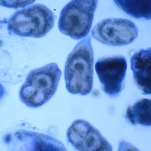Protoscoleces liberated from a hydatid cyst. Adapted from CDC