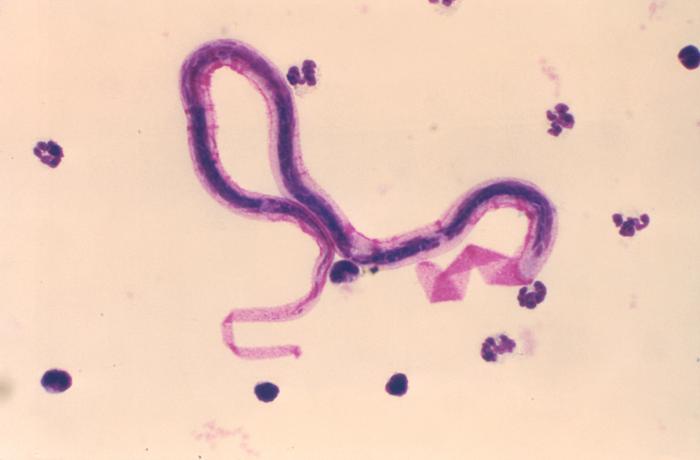 Photomicrograph reveals some of the ultrastructural details displayed at the posterior end of the microfilarial-staged nematode, Brugia malayi, one of the organisms responsible for the disease known as lymphatic filariasis. From Public Health Image Library (PHIL). [3]