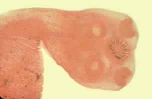 Unstained Taenia sp. egg, teased from a proglottid of an adult. Four hooks can easily be seen in this image. Adapted from CDC