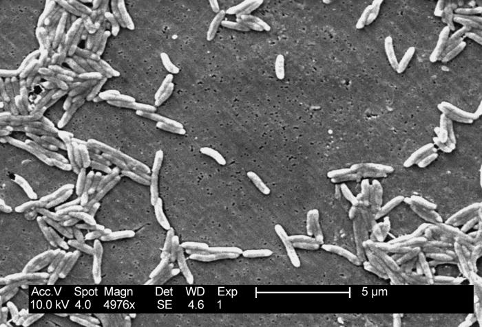 Scanning electron micrograph depicts a grouping of Gram-negative Campylobacter fetus bacteria (4,976x mag). From Public Health Image Library (PHIL). [1]