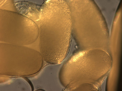 Close-up of the eggs from the specimen in Figure 2. Adapted from CDC