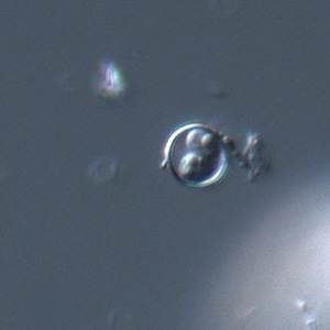 Oocyst of C. cayetanensis viewed under DIC microscopy. There are two sporocysts are visible in this image. Adapted from CDC