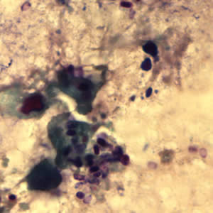 File:Ecuniculi spores gramchromo2 2012.jpg
