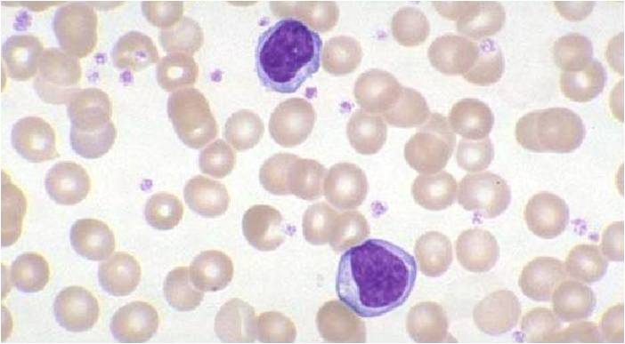 Lymphocytes and Thrombocytes