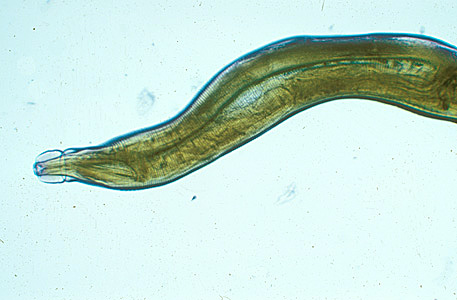 Adult of Oesophagostomum sp. Adapted from CDC