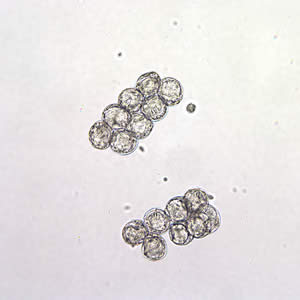 D. caninum eggs clumped together in a wet mount. Image taken at 200x magnification. Adapted from CDC