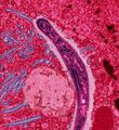 This false-colored electron micrograph shows a malaria sporozoite migrating through the midgut epithelia