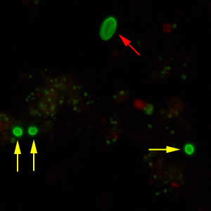 Cryptosporidium sp. oocysts (yellow arrows) and cysts of Giardia duodenalis (red arrow) labeled with immunofluorescent antibodies. Adapted from CDC
