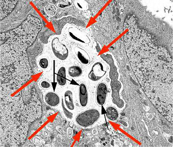 Transmission electron micrograph of E. intestinalis depicting developing forms inside a parasitophorous vacuole (red arrows) with mature spores (black arrows). Adapted from CDC