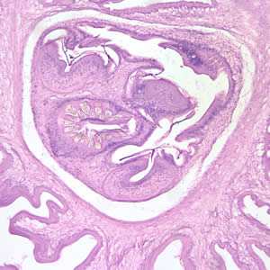 Cross-sections of cysticerci stained with H&E, at 100x magnification. Adapted from CDC