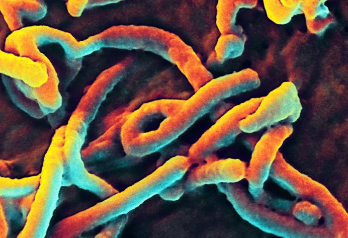 Produced by the National Institute of Allergy and Infectious Diseases (NIAID), under a magnification of 50,000X, this scanning electron micrograph (SEM) depicts numerous filamentous Ebola virus particles replicating from an infected VERO E6 cell. From Public Health Image Library (PHIL). [4]