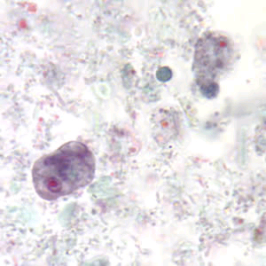 Trophozoites of E. nana stained with trichrome. Adapted from CDC