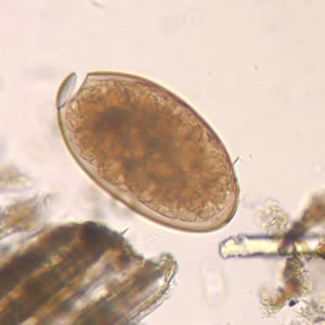 Egg of F. hepatica in an unstained wet mount, taken at 400x magnification. Adapted from CDC