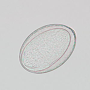 Egg of M. moniliformis liberated from an adult worm that was recovered from the stool of a patient. Adapted from CDC