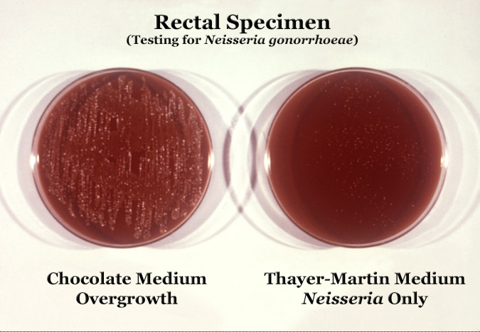 Neisseria gonorrhoeae cultured on two different media types.