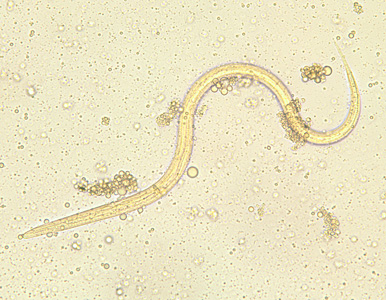 Higher magnification (1000x oil) of the worm in Figure 2. Notice the notched tail. Adapted from CDC