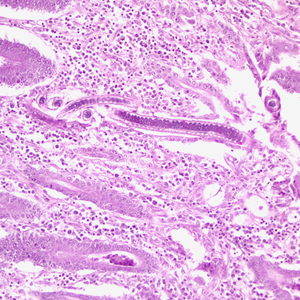 Longitudinal section of an adult C. philippinensis from an intestinal biopsy specimen, stained with H&E. Adapted from CDC