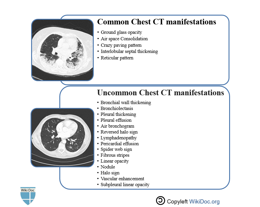 File:CT-manifestations-COVID19.PNG
