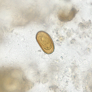 Egg of D. dendriticum in an unstained wet mount of stool. Adapted from CDC